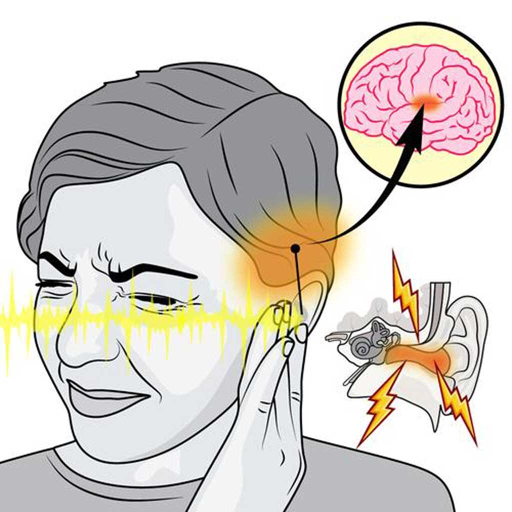 Why Do My Ears Make Noise | Worcester, MA | Tinnitus Evaluation